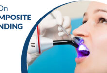 All on Composite Bonding - Dental Clinic London