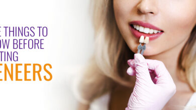 Five Things to Know Before Getting Veneers - Cosmetic Dentistry Clinic