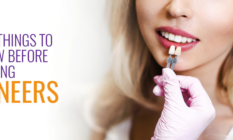 Five Things to Know Before Getting Veneers - Cosmetic Dentistry Clinic