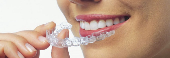 Teeth Straightening Treatment