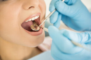 teeth whitening price in Pakistan