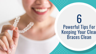 6 Powerful Tips For Keeping Your Clear Braces Clean - Chatfield Dental Braces