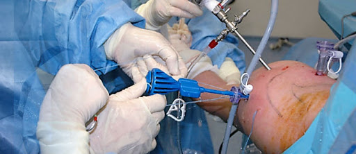 best Arthroscopic surgeon in Delhi