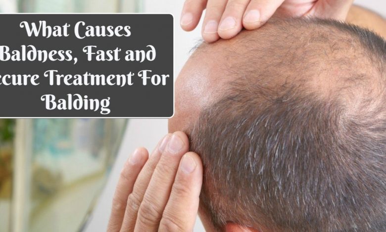causes of bald spots- What Causes Baldness, Fast and Secure Treatment For Balding