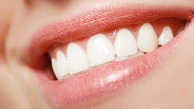 adult braces