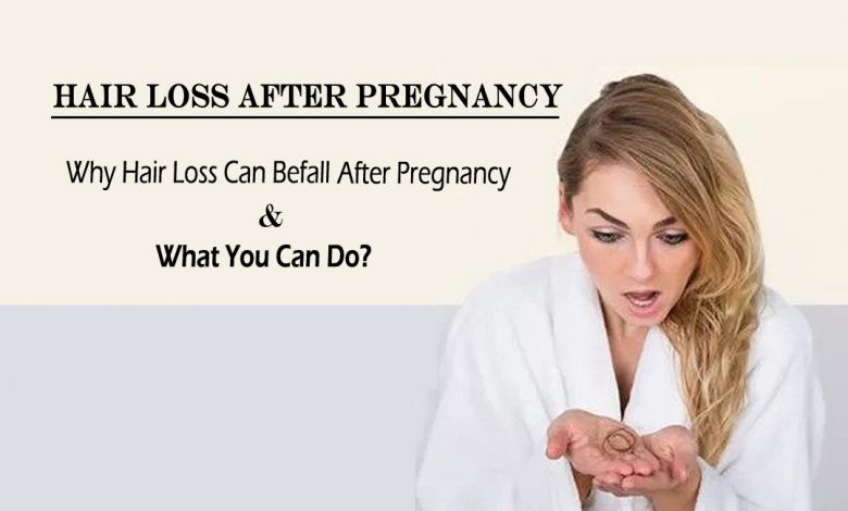 hair loss after pregnancy- Why Hair Loss Can Befall After Pregnancy and What You Can Do?