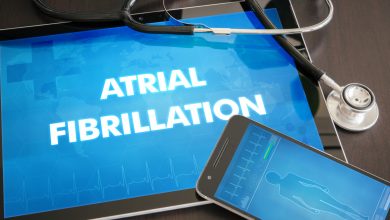 atrial fibrillation ablation
