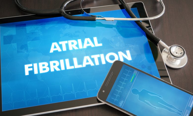 atrial fibrillation ablation