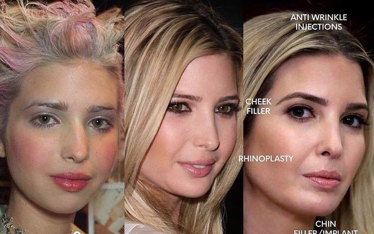 Botox Boston