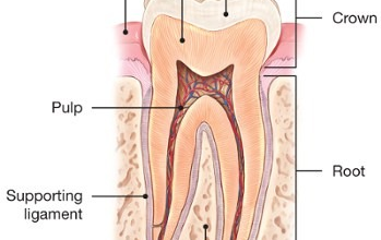 Root Canal Cracked Tooth