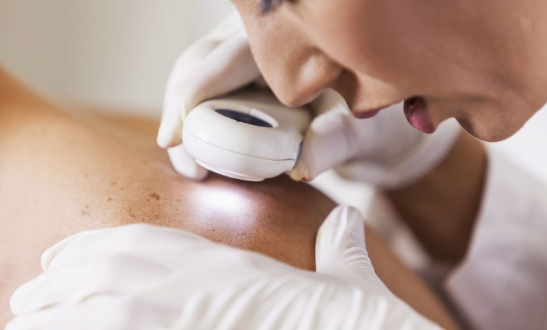 dermatologist encino