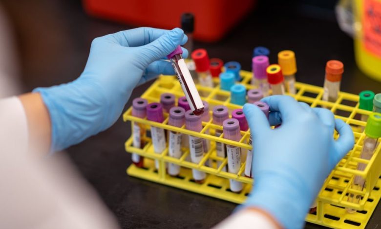 lab testing