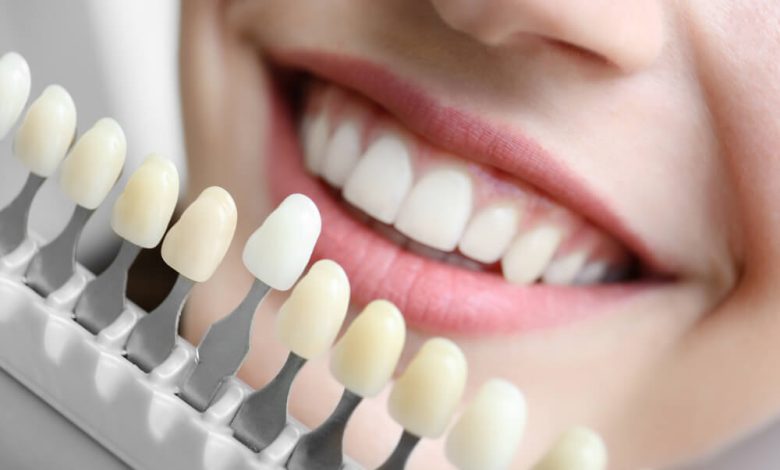 affordable dentist near me
