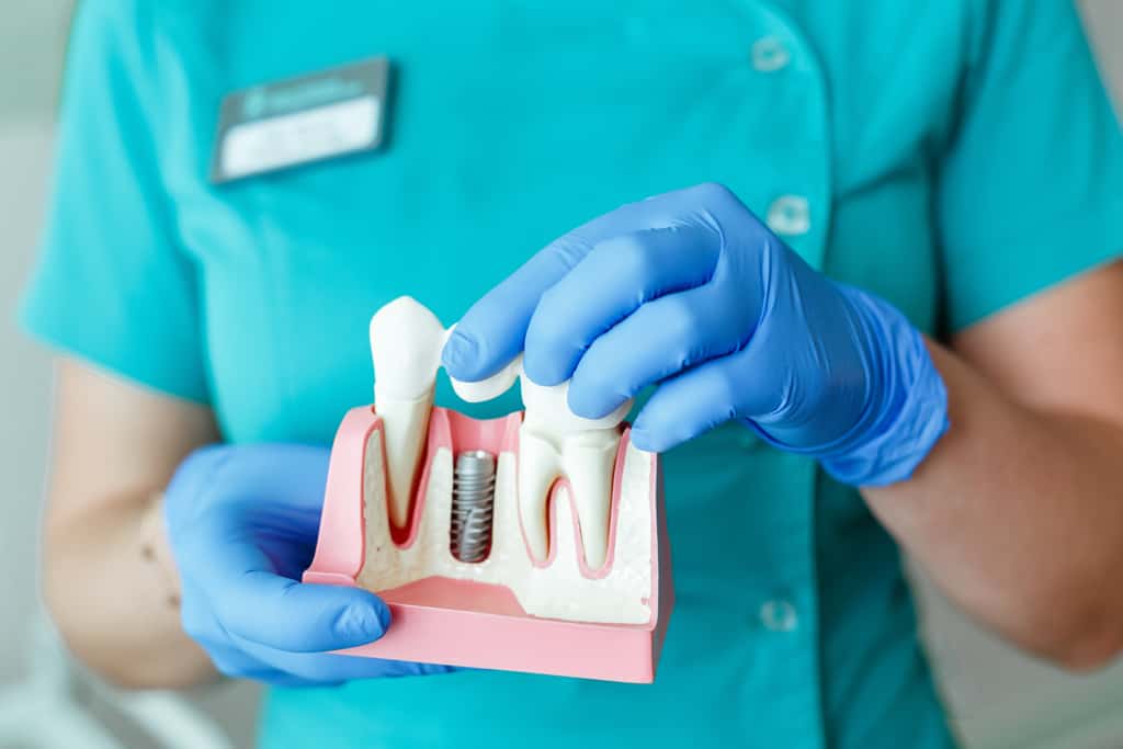 Dental Implants Periodontists
