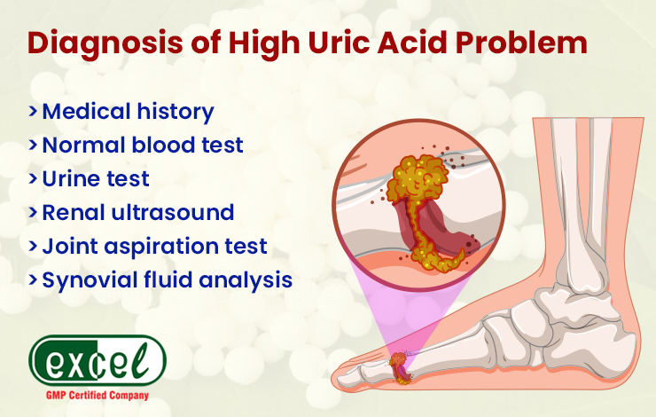 Diagnosis of High Uric Acid Problem