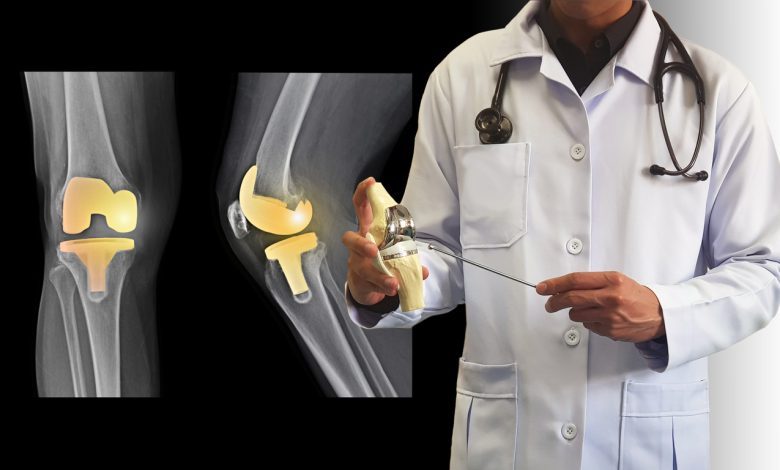 joint replacement recovery