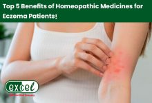 Best Homeopathic Medicine for Eczema