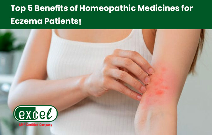 Best Homeopathic Medicine for Eczema