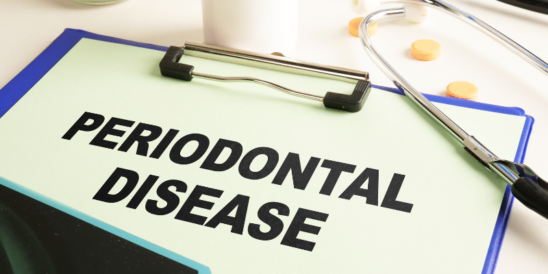 Periodontal Disease 