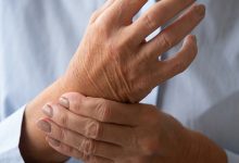 Viscosupplementation Treatment for Arthritis: What You Need to Know