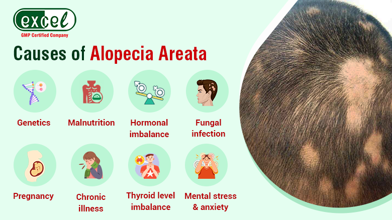 Alopecia Areata Homeopathic Treatment